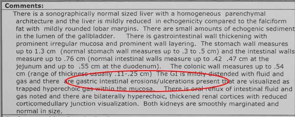 Ultrasound report of ulcers
