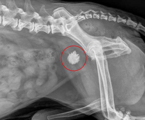 X-ray of bladder stone