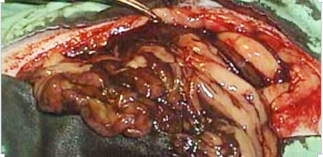cancerous ferret liver lobe.