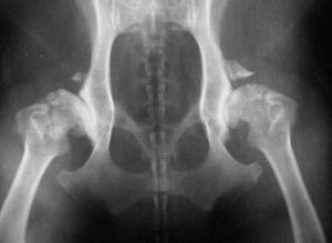 X-Ray of dog with severe hip dysplasia