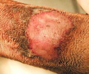 Acral lick dermatitis appearance on the skin.