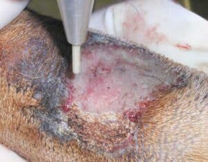 Laser treatment of lick dermatitis.