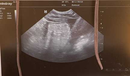 Ultrasound screen of Ultrasound of pregnant rhino