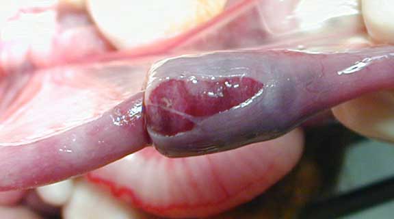 What an intussusception looks like during surgery.