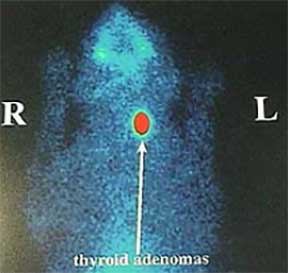 Feline thyroid scan.