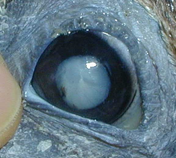 Pelican cataract.