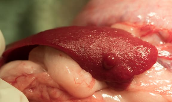 Spleen during surgery