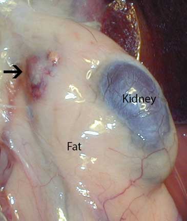 Kidney and inflamed adrenal gland buried in fat