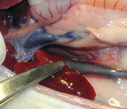 The vena cava as seen during surgery.